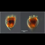 coxiella-form of  Protorhabdonella curta?