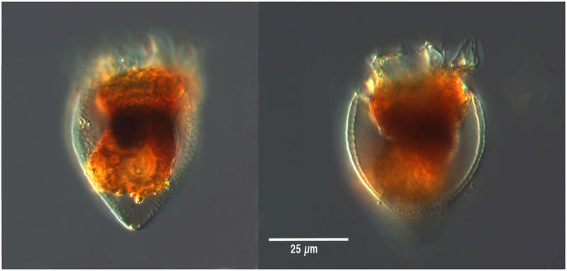 coxiella-form of  Protorhabdonella curta?