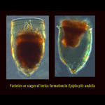 Different forms of Epiplocylis undella