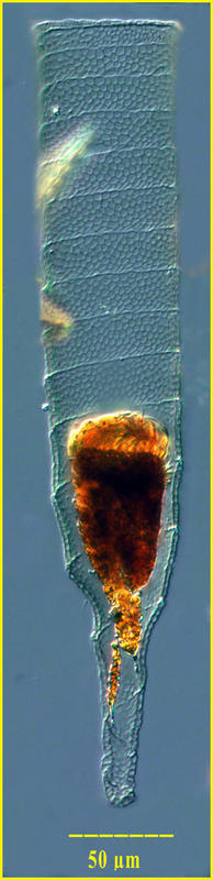 Xystonella lohmanni 'Stage'