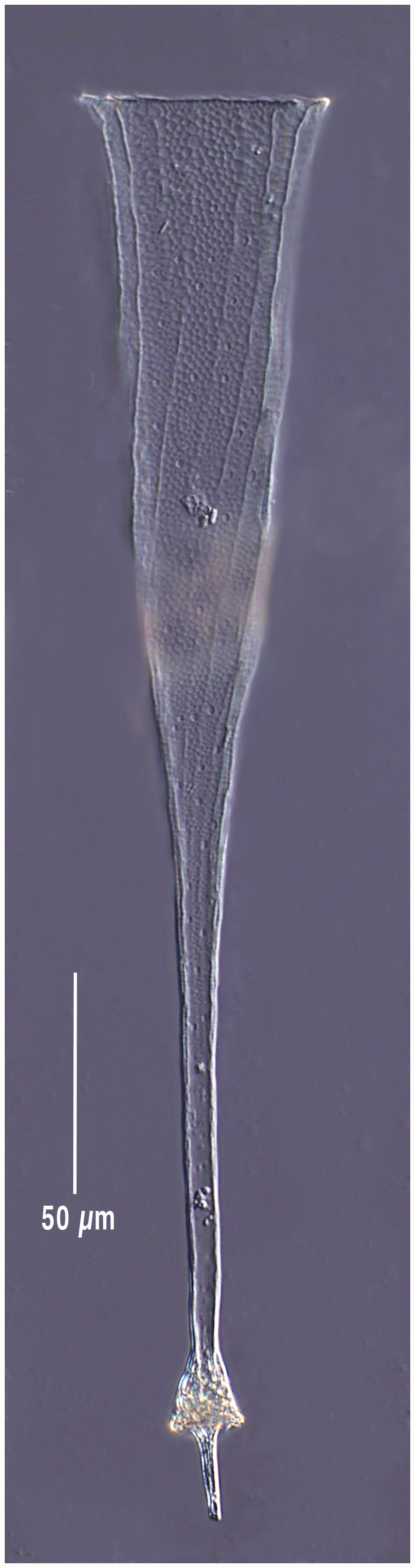 Lorica of Rhabdonellopsis longicaulis