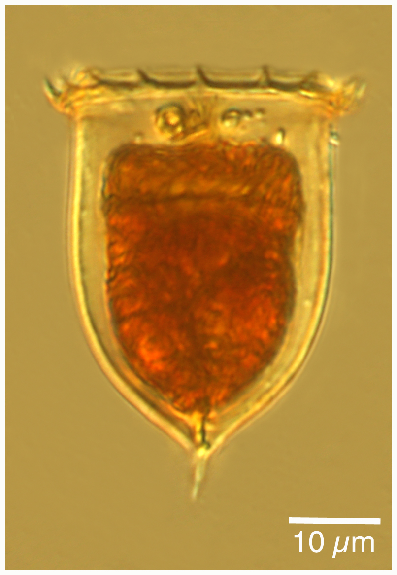 Acanthostomella norvegica