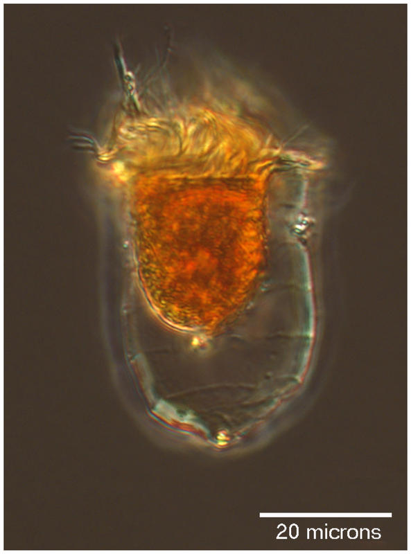 Acanthostomella norvegica 'coxliella form'