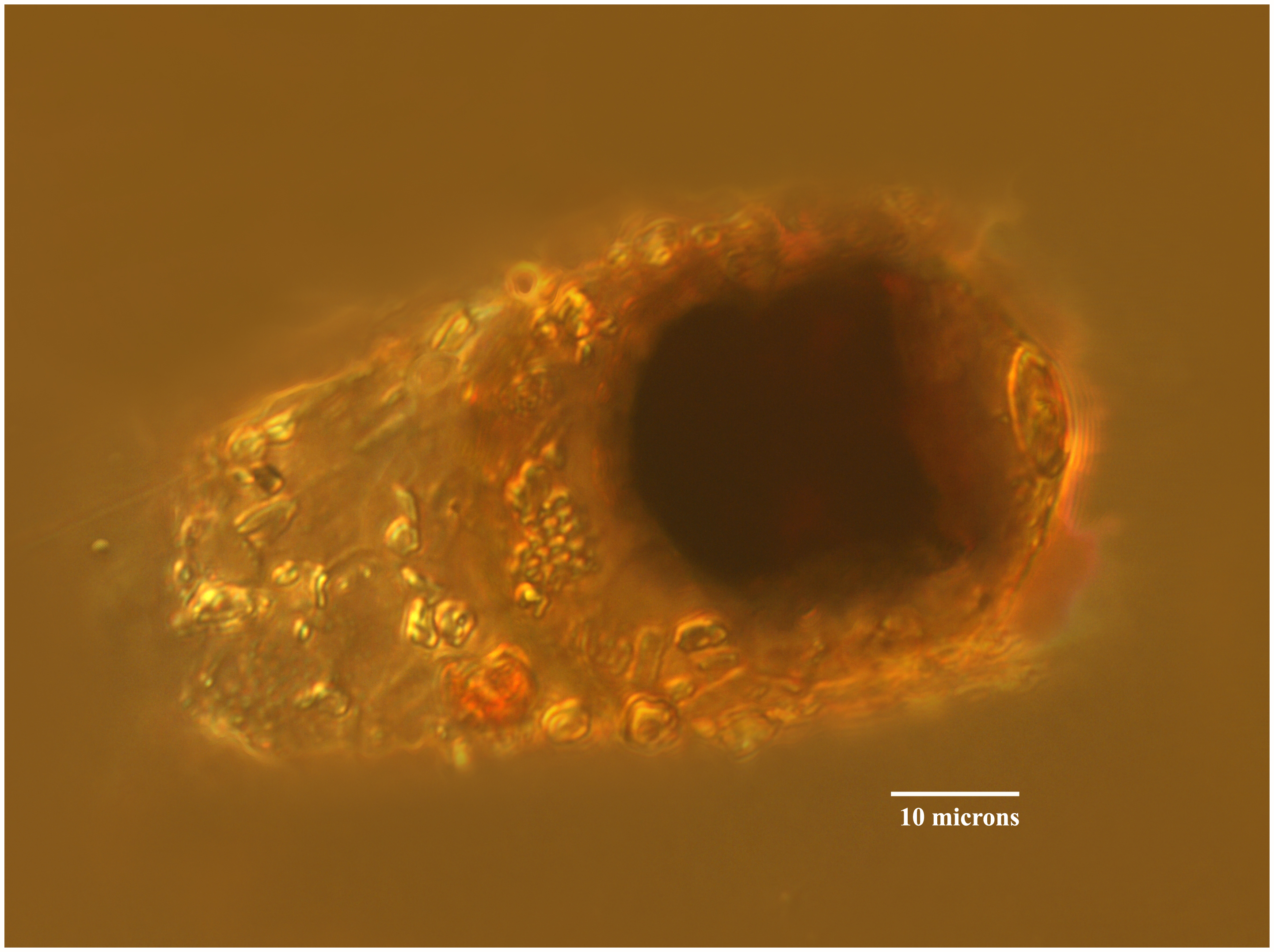 cyst of Leprotintinnus pellucidus