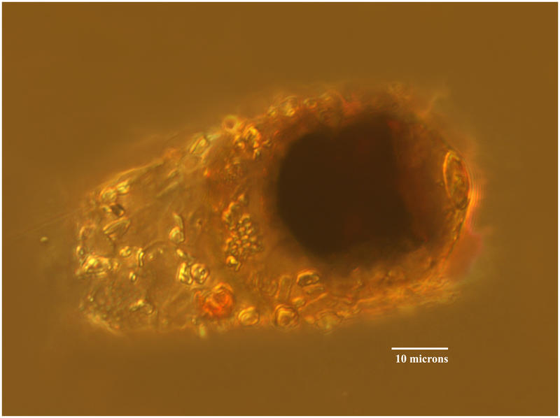 cyst of Leprotintinnus pellucidus