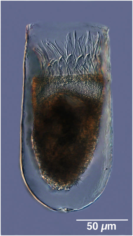 Bursaopsis vitrea