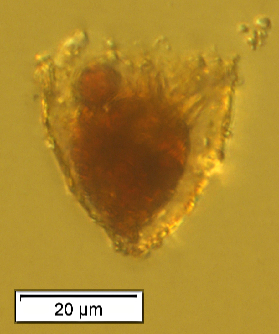Tintinnopsis subacuta (maybe)