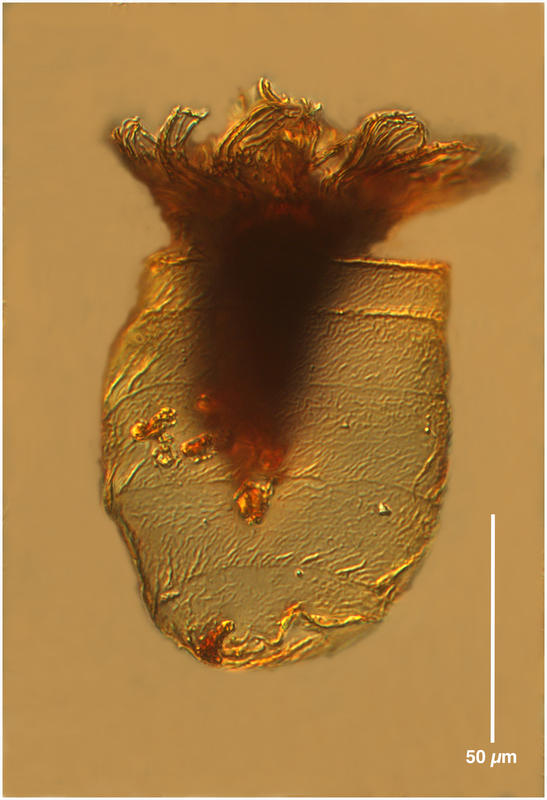 coxliella form of Ptychocylis obtusa