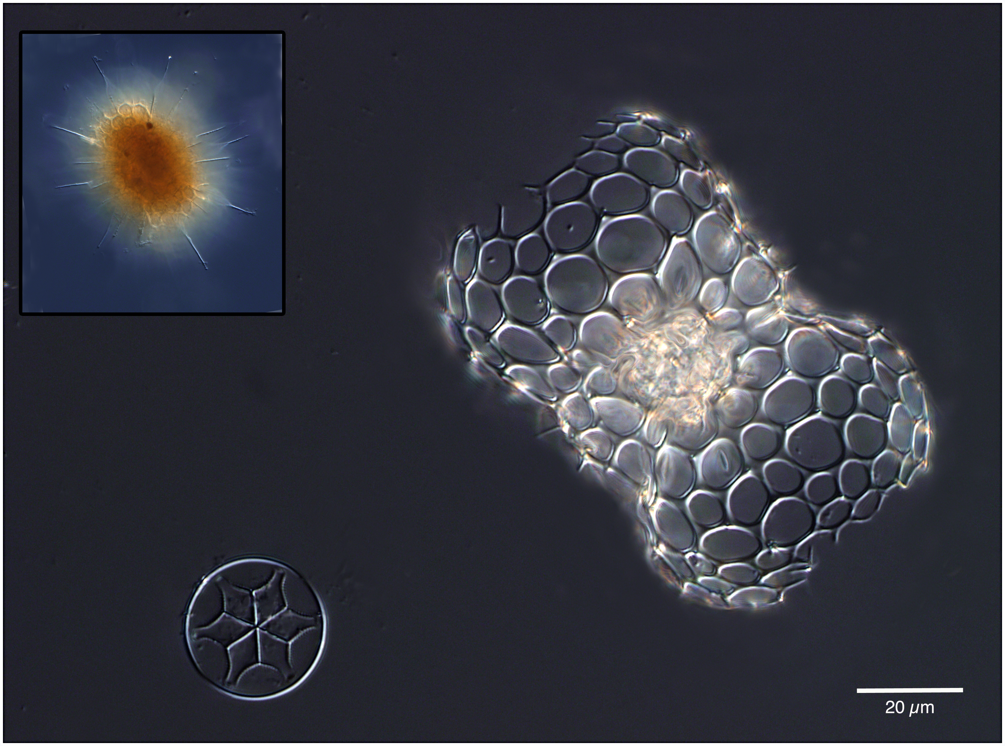 Radiolarian