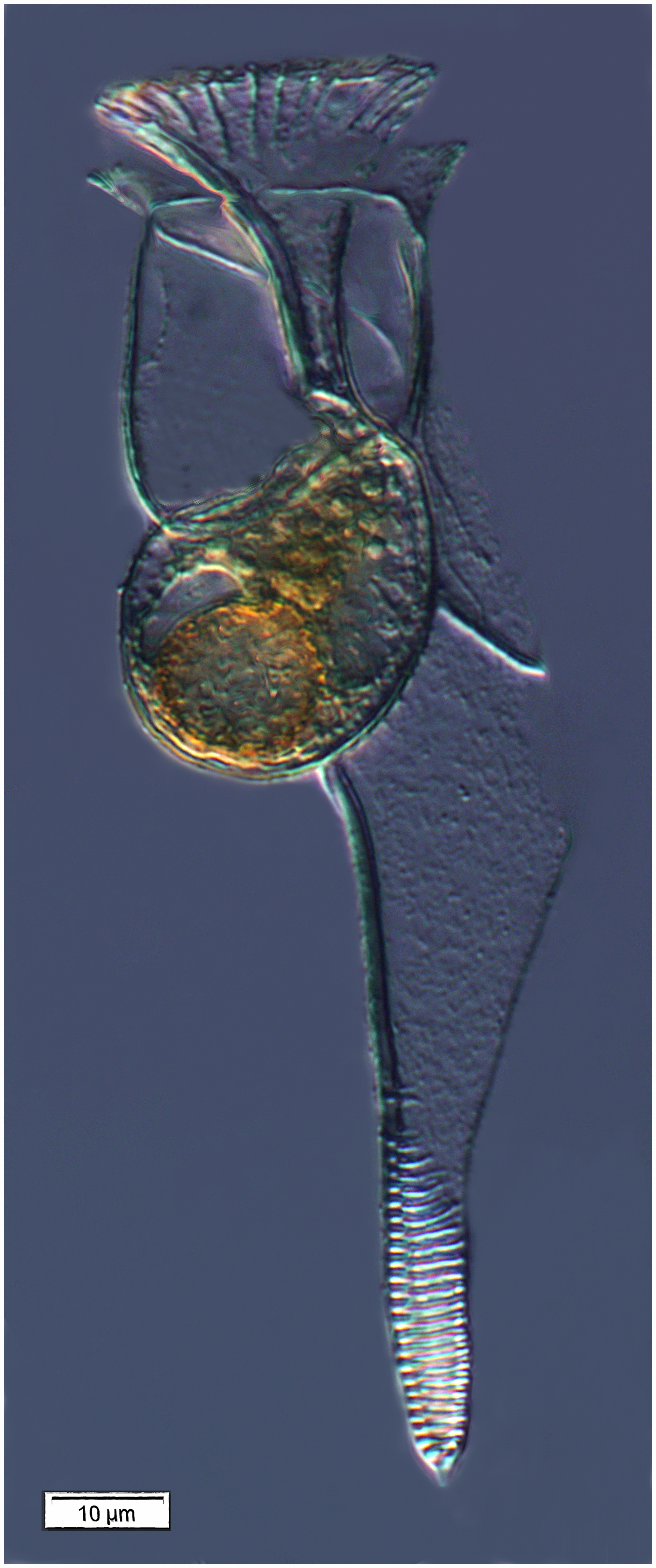 Histioneis elongata (Kofoid & Michener 1911)