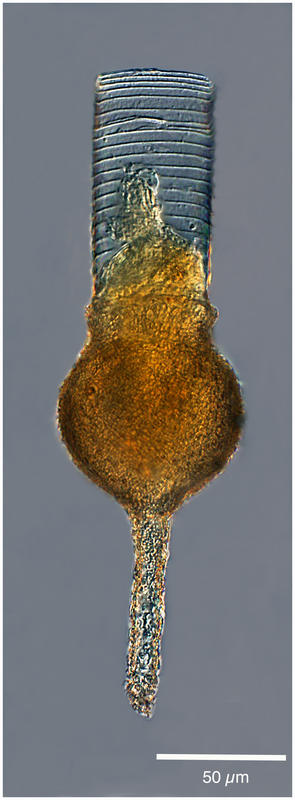 Codonellopsis longa