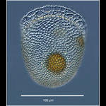 Cyttarocylis ampulla: the brandti morph