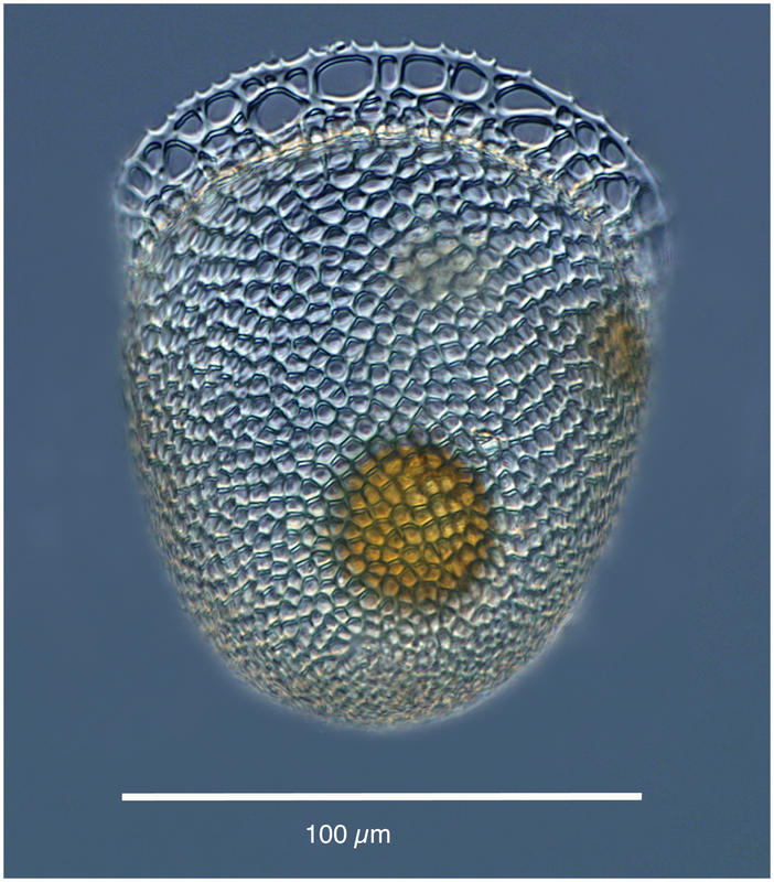 Cyttarocylis ampulla: the brandti morph