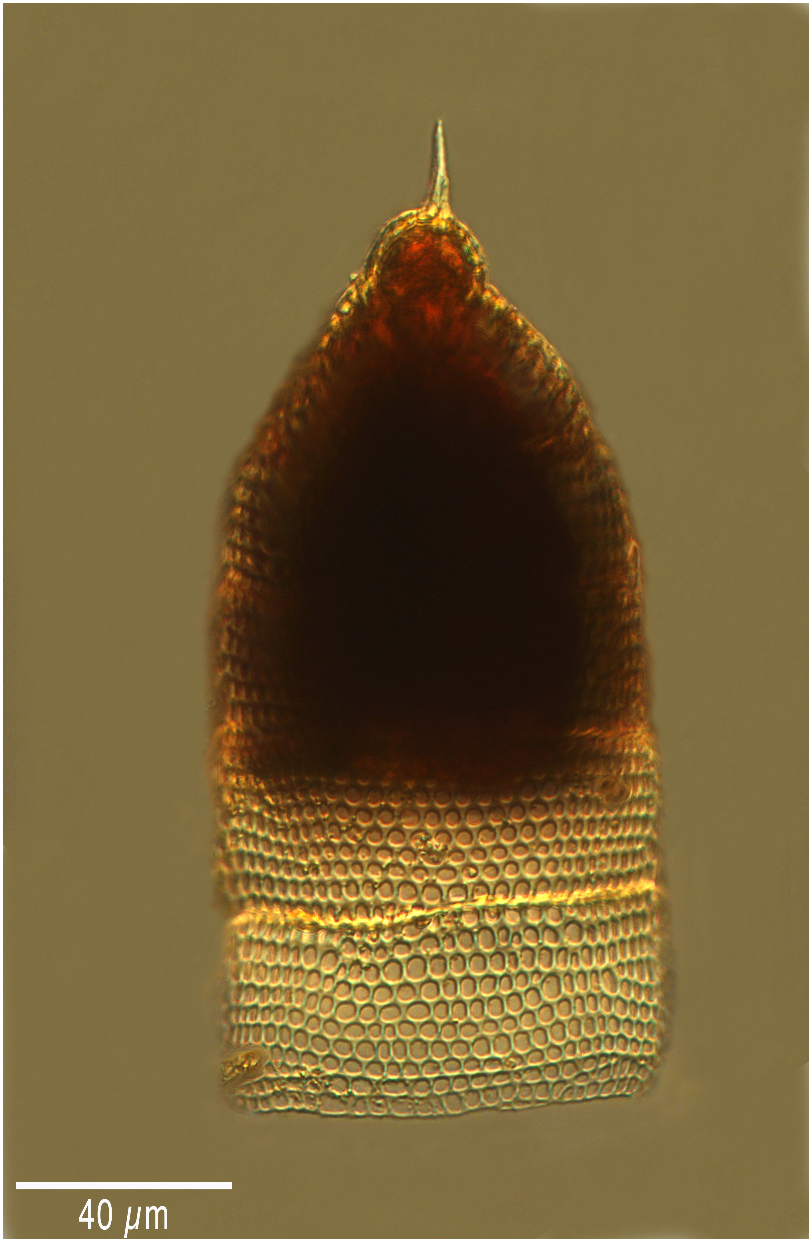 Eucyrtidium acuminatum (Ehrenberg 1847)