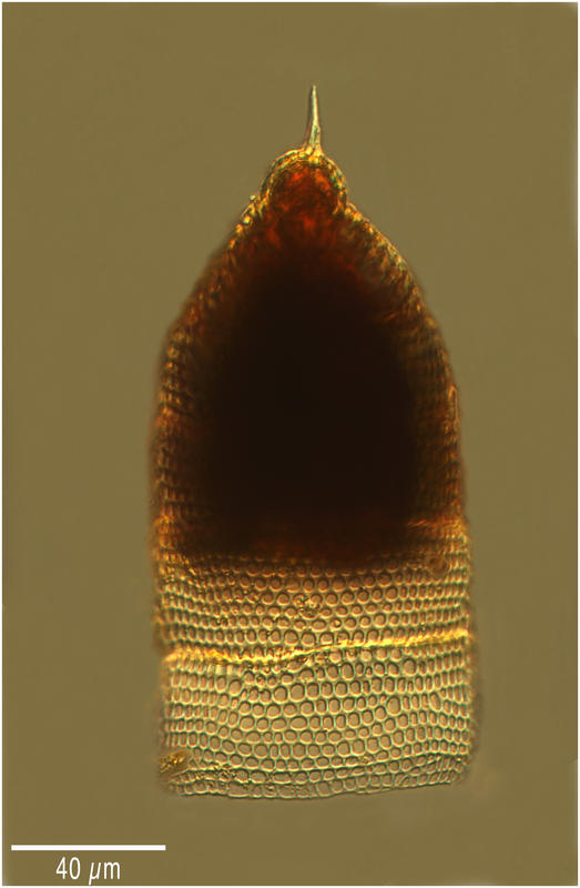 Eucyrtidium acuminatum (Ehrenberg 1847)