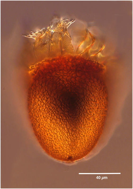 Cyttarocylis ampulla forma brandti