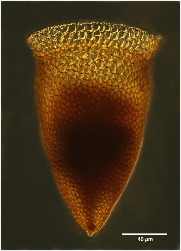 Cyttarocylis ampulla (forma cassis)