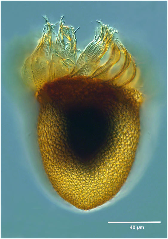 Cyttarocylis ampulla (forma eucecryphalus)