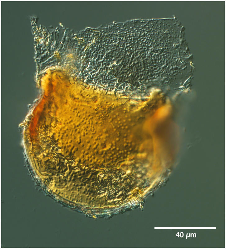 Cyttarocylis ampulla forming a new lorica