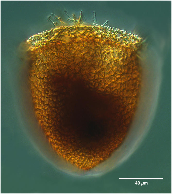 Cyttarocylis ampulla (forma eucecryphalus )