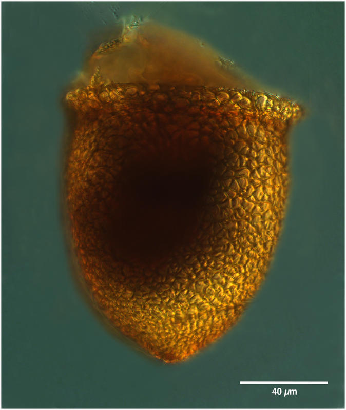 Cyttarocylis ampulla (forma eucecryphalus)