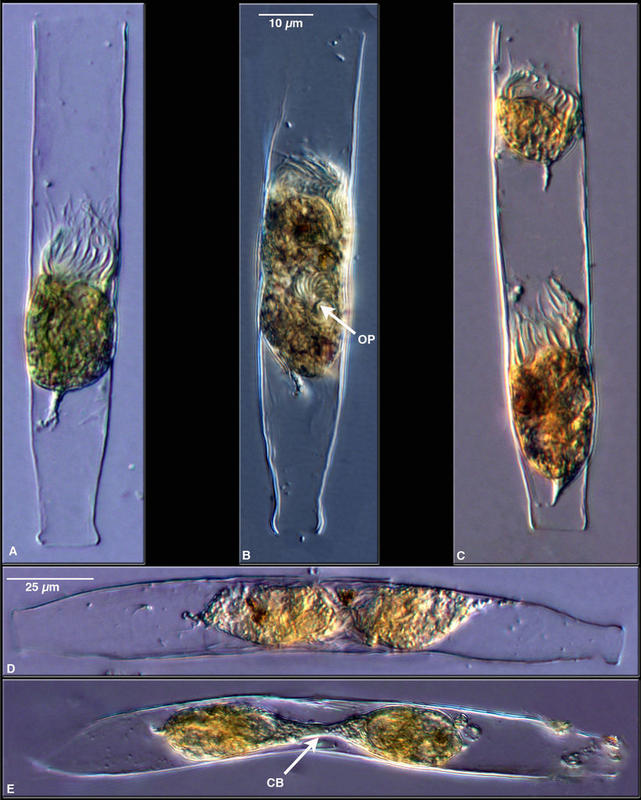 Life history stages of a tintinnid, Eutintinnus inquilinus