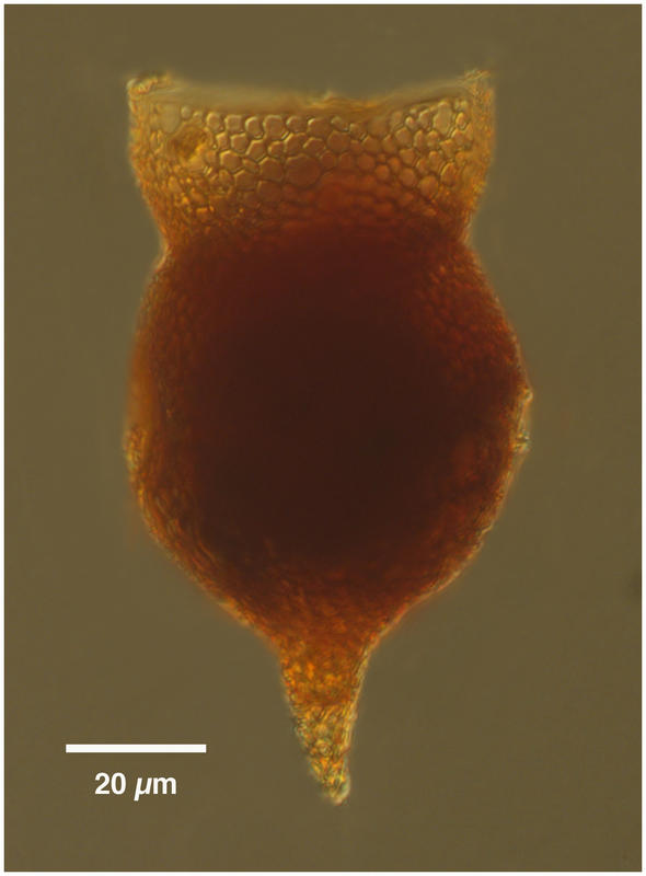 Codonella amphorella