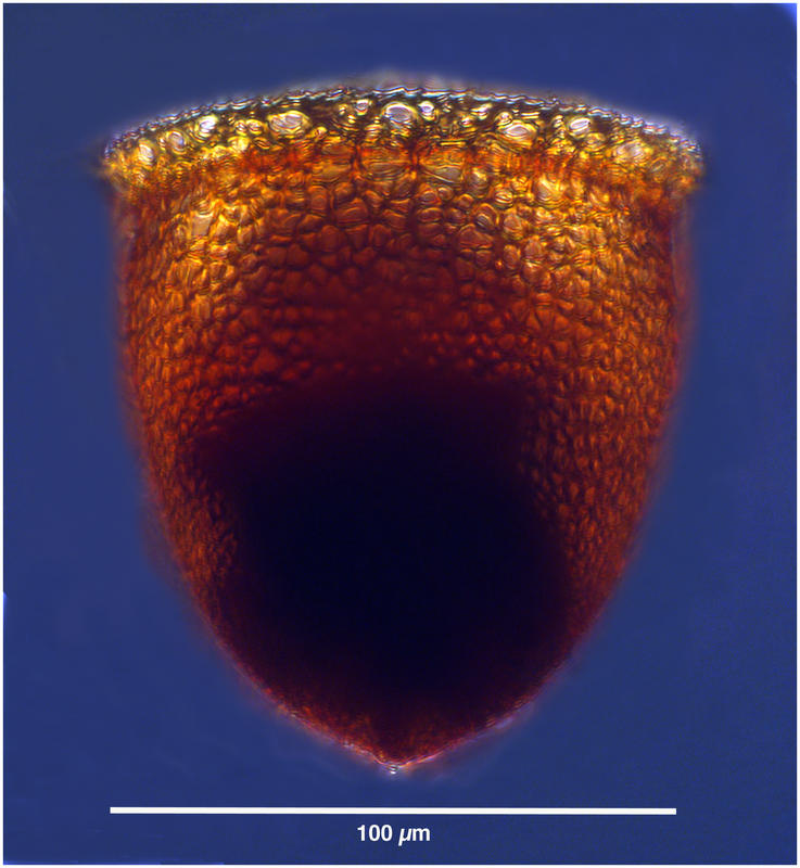 Cyttarocylis ampulla forma eucecryphalus