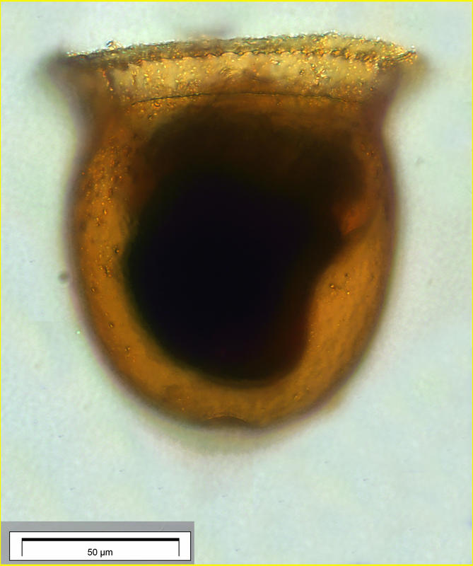 Cyttarocylis ampulla forma ampulla