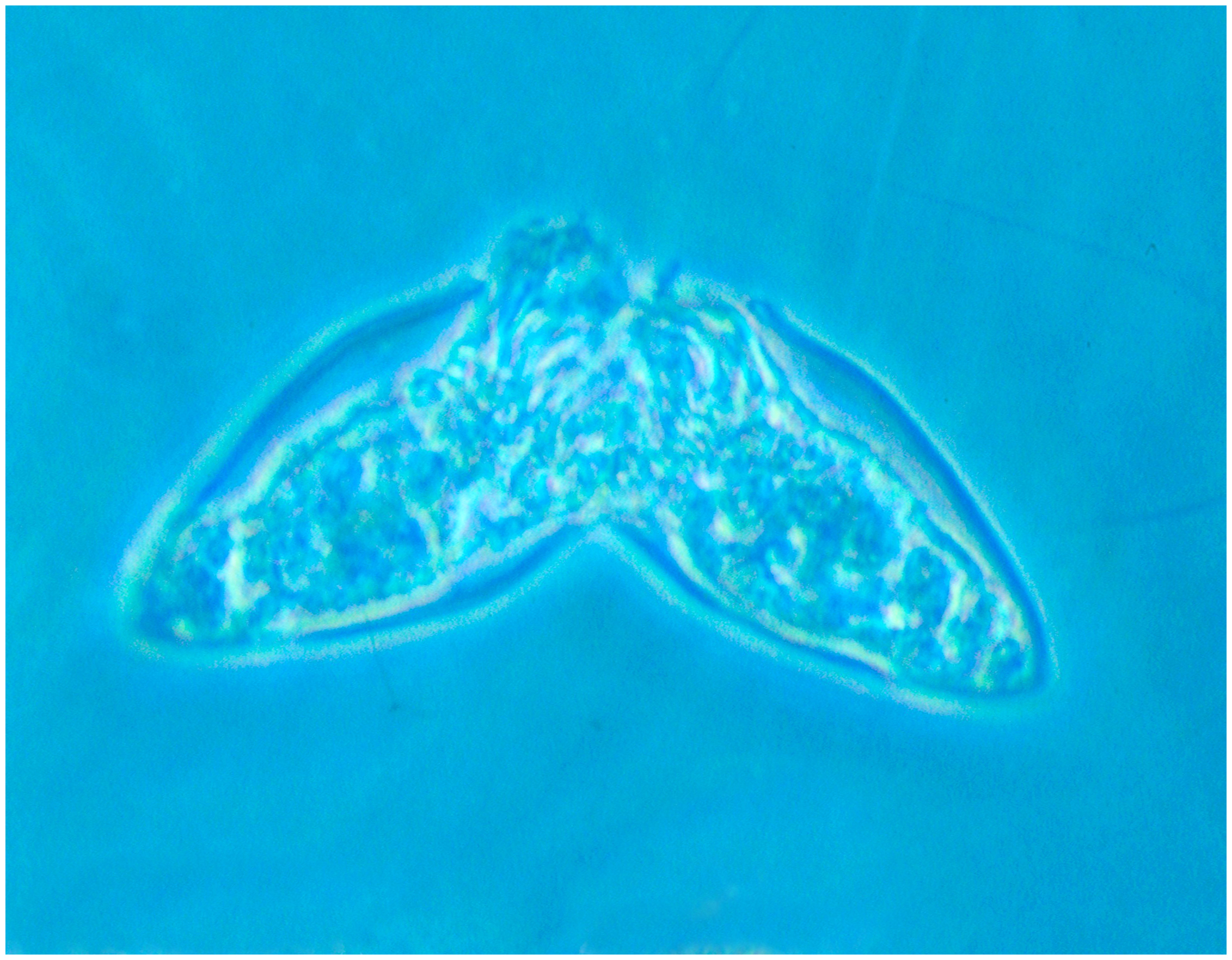 Protorhabdonella curta