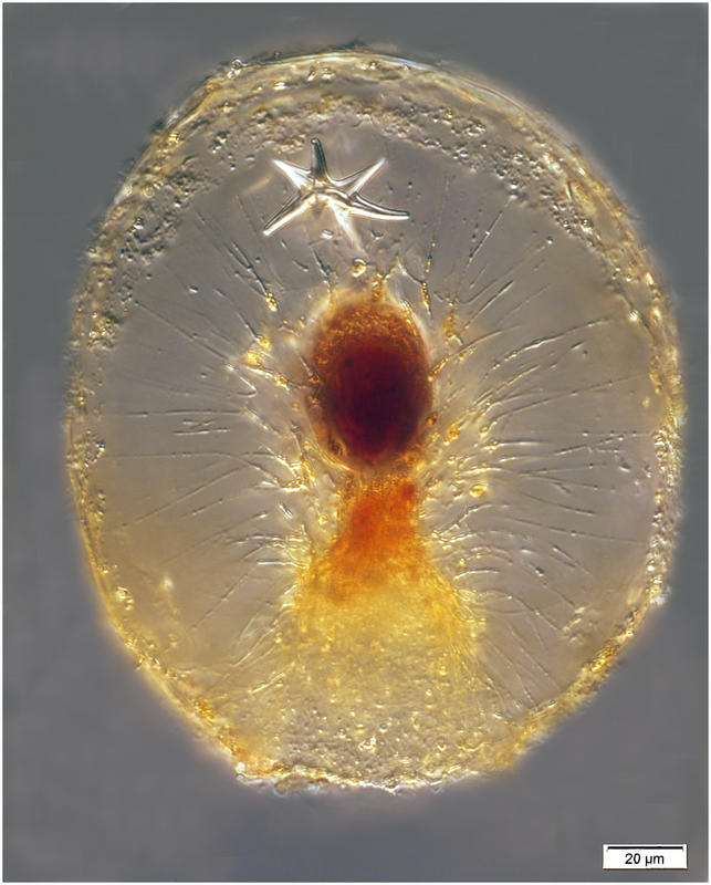 Paracystidium spiculosum (Hollande & Enjumet 1960)