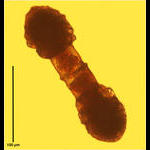 Codonellopsis morchella conjugation