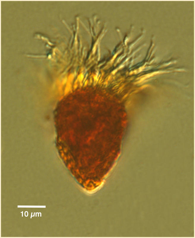 Strombidium-type oligotrich lugol's-fixed.