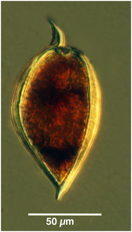 Prorocentrum micans