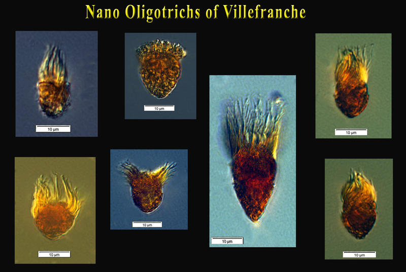 Nano oligotrichs !