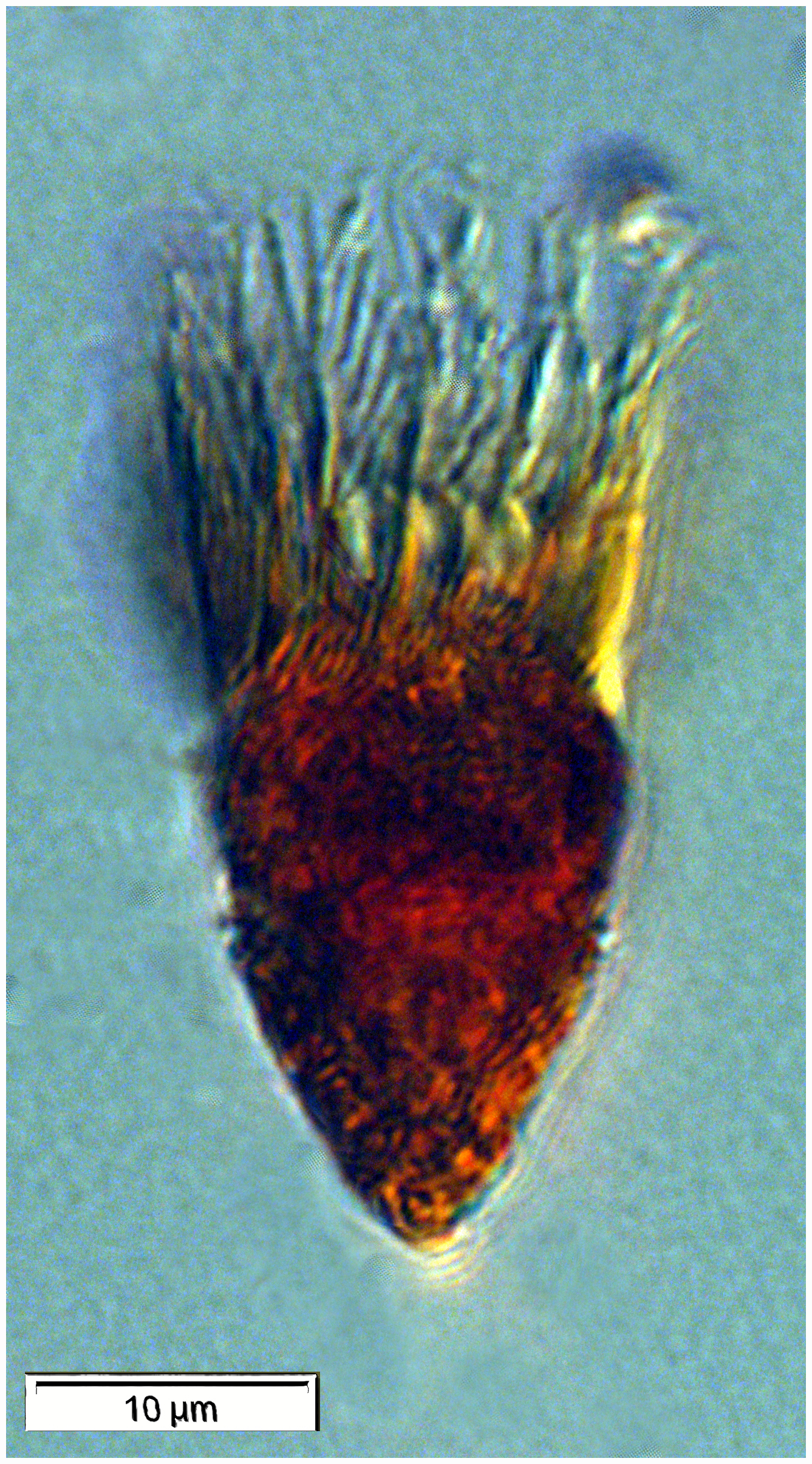 Small Strombidium type