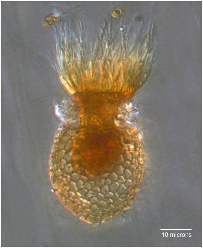 Codonellopsis pussila