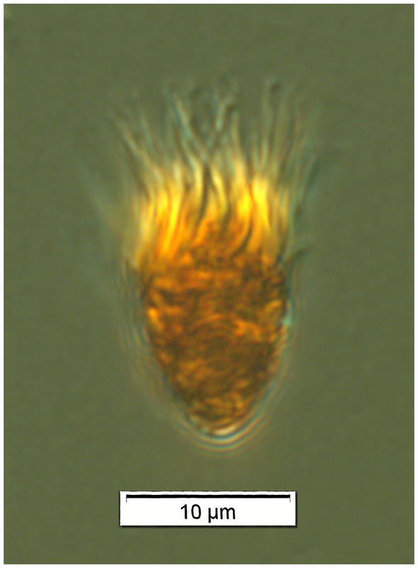 Nano-sized Strombidiid oligotrich ciliate