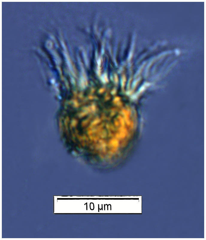 Nano sized Stobilidiid?