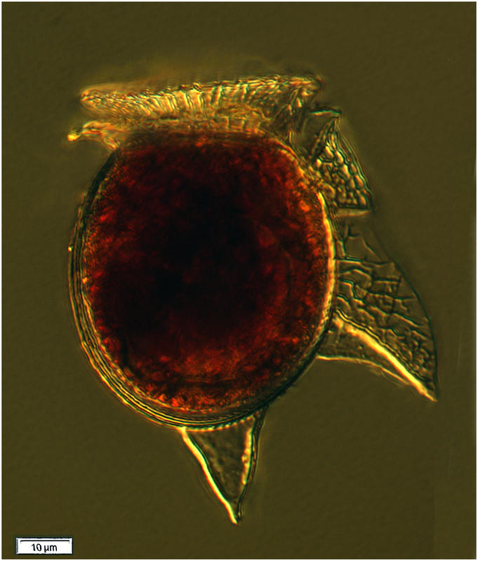 Dinophysis odiosa