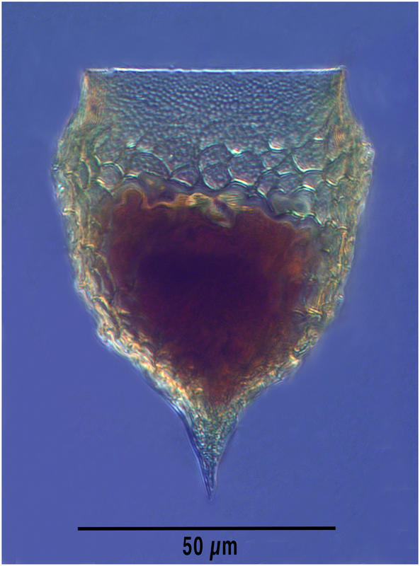 Epiplocylis acuminata Daday 1887