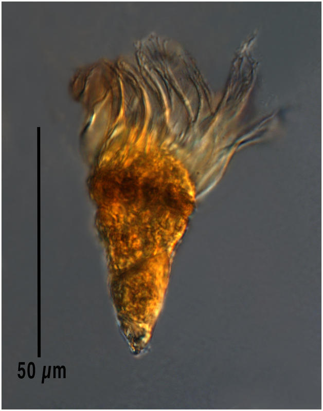 Another tontonid oligotrich ciliate