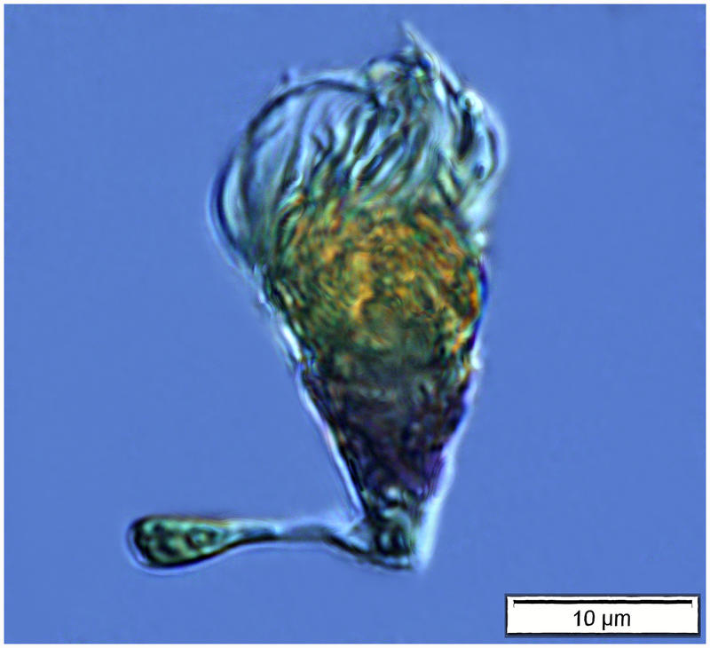 A tiny Tontonid oligotrich