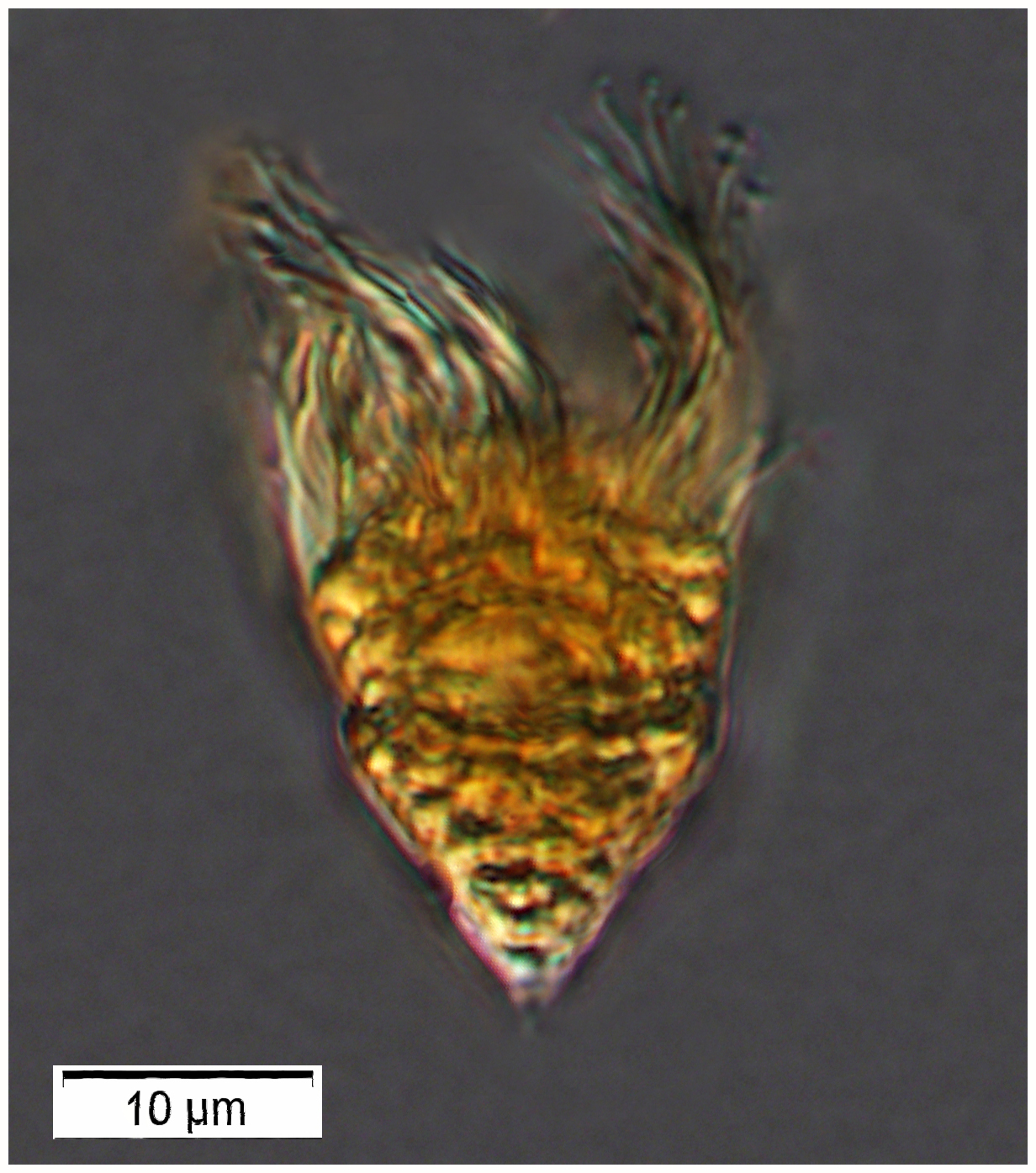 Nano-sized Strombidium-type