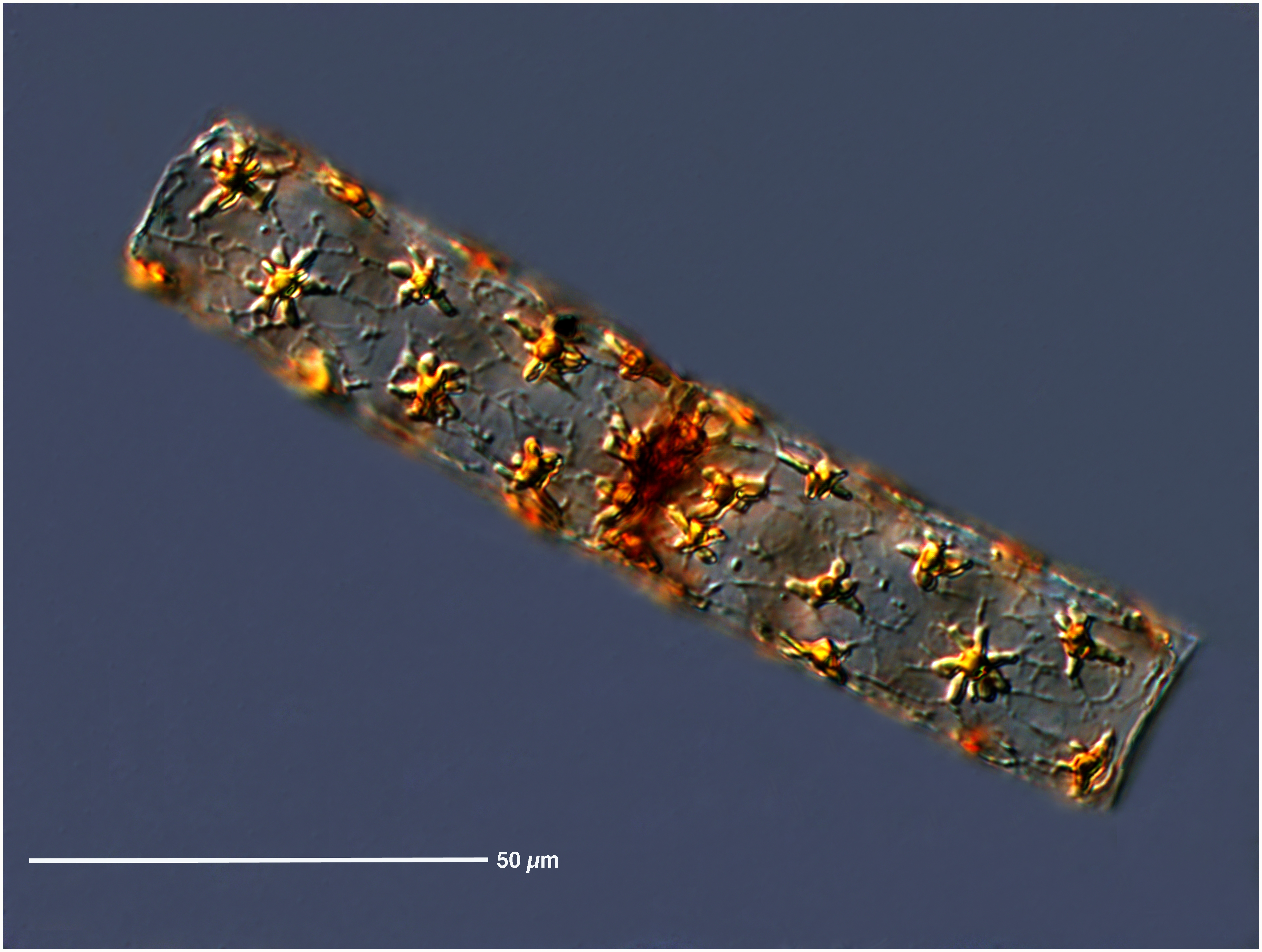 Star Stick Diatom