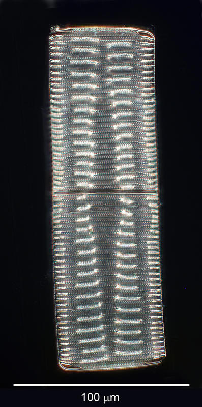 Diatom Tower