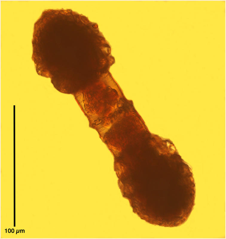 Conjugating pair of Condonellopsis morchella