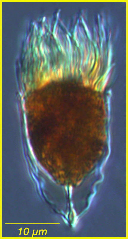 An aberrant form or developmental stage of Acanthostomella conicoides.