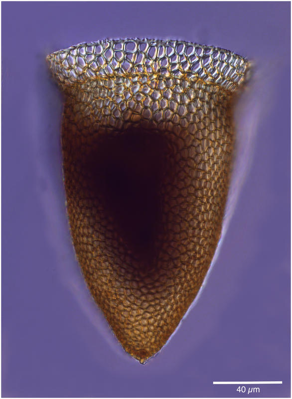 Cyttarocylis ampulla (forma cassis)