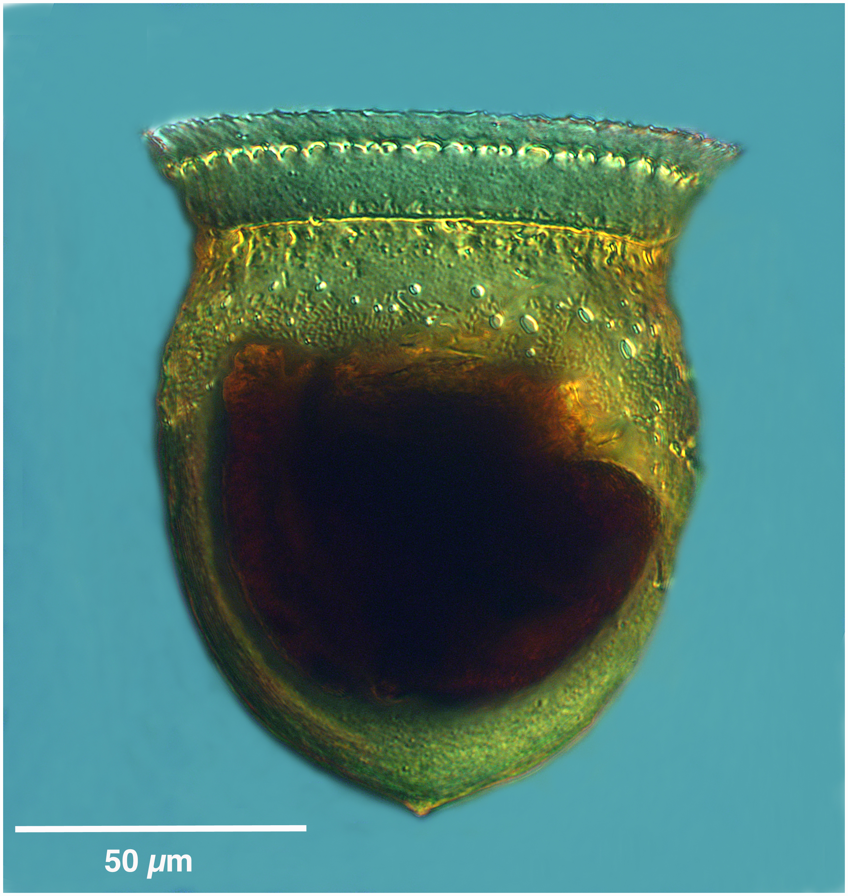 Petalotrich ampulla (Cyttarocylis ampulla forma ampulla)
